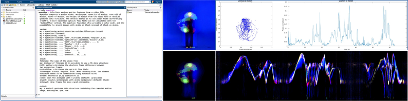 MGT for Matlab